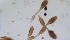 Spore di Alternaria al microscopio ottico ad ingrandimento 400x (foto archivio ARPAS)