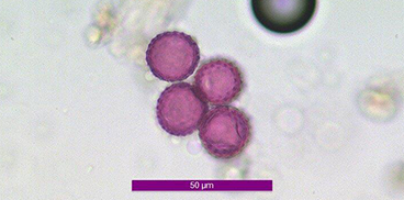 Pollini di ambrosia al microscopio ottico 400x